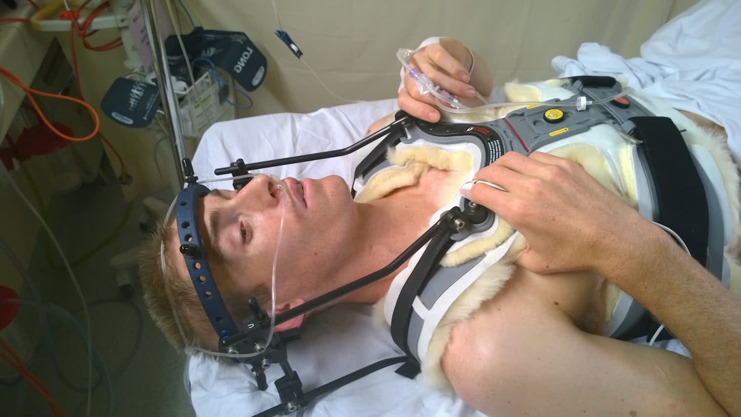 steve plain, halo brace, neck brace, mountaineer, injury
