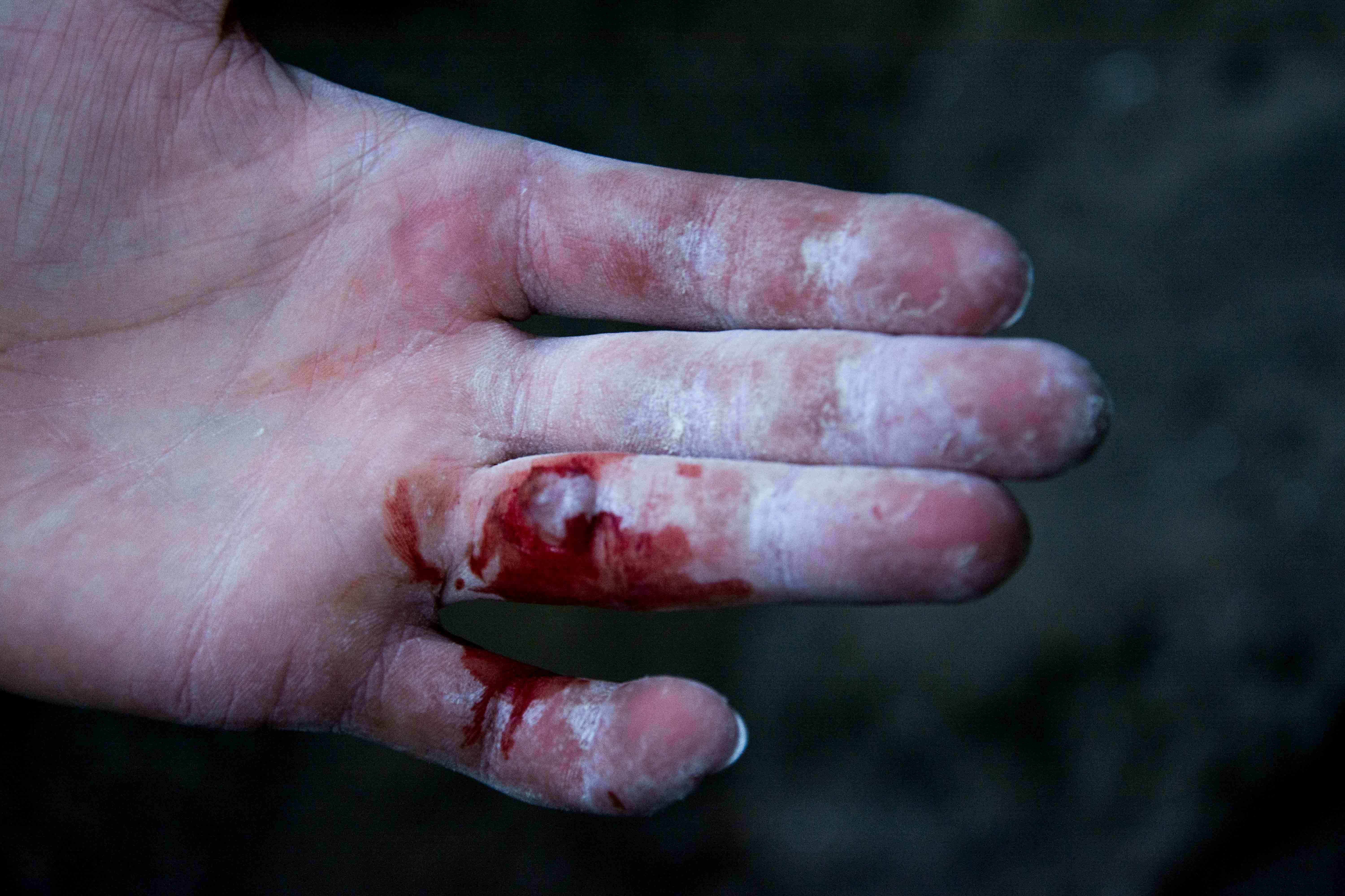 Mitch Scanlan-Bloor, Flapper, hand, caring for your hands when rock climbing, chalk, climbing month
