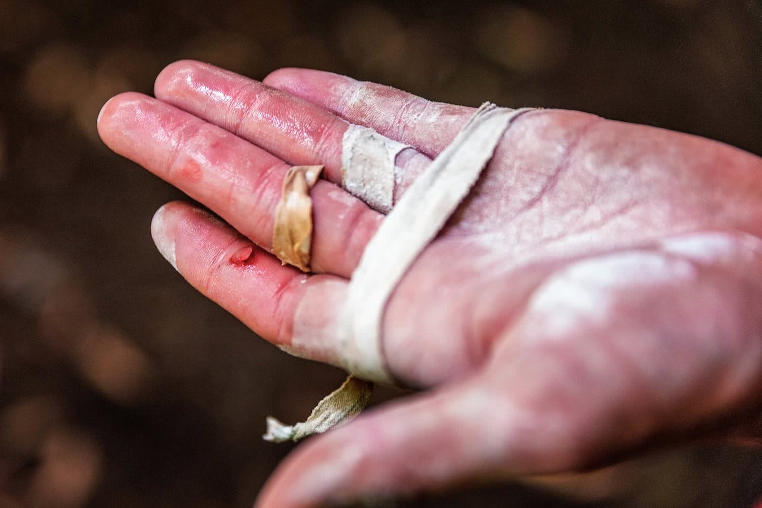 less talk more chalk, Michael evans, mevans photography, hand, sore, flapper, injury, chalk, beginner rock climbing gear