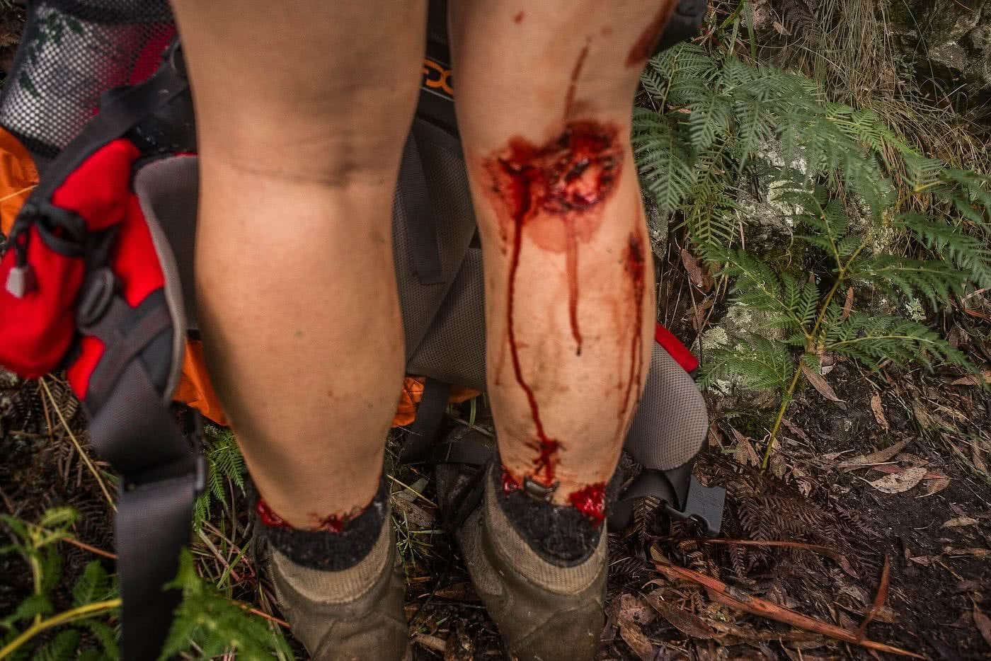 Knowing When To Call It by Lachie Thomas hiking, blood and leeches